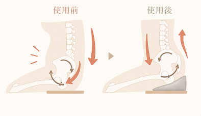 骨盤が立たない人の骨盤の図